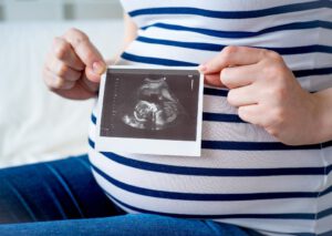 3D _ 4D – Ultraschall