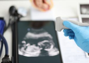 Pränatale Diagnostik_ Einblick in die Entwicklung Ihres Kindes