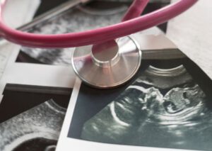 Ultraschalldiagnostik in der Schwangerschaft_ Ein Fenster zum Ungeborenen